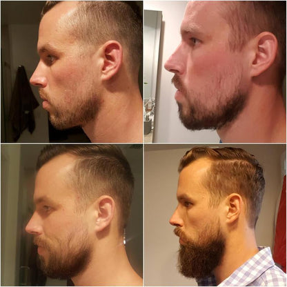 Beard Growth Kit - TILLARE Beard Grooming Kit with Beard Growth Oil, Balm, Comb, Massager, Christmas & Birthday Gifts for Men Husband Dad Boyfriend