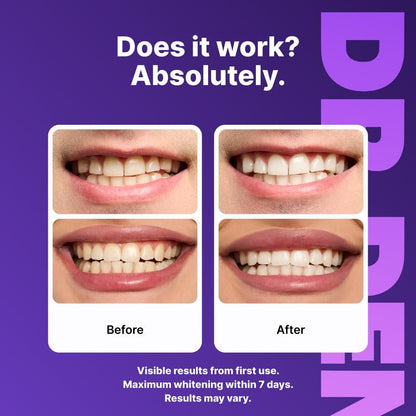 DRDENT Purple Teeth Whitening Strips - 21 Sessions for a Bright Smile - Enamel Safe & Non-Sensitive Formula - Peroxide-Free Whitening Solution