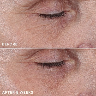 Olay Regenerist Anti-Aging Eye Wrinkle Treatment, Firming & Hydrating 0.68 fl oz - Imperfect Box
