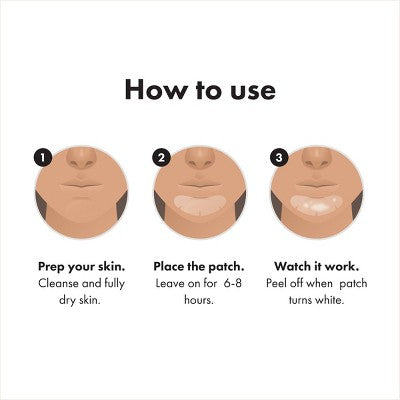 Hero Mighty Patch Chin 10ct - Imperfect Box