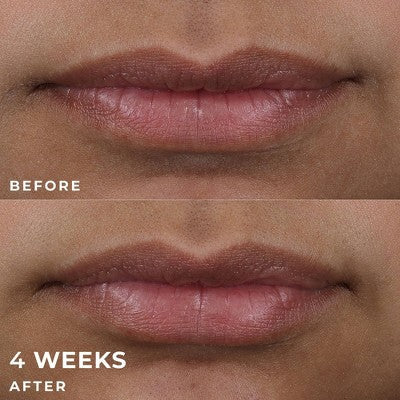 RoC Derm Correxion Lip Volumizer Treatment 0.34 fl oz - Missing Box