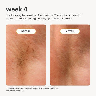 Nood After Care Serum 3.3 fl oz - Imperfect Container