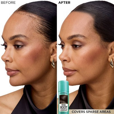 L'Oreal Paris Magic Root Cover Up Systems Light Golden Brown 2.0oz - Imperfect Container