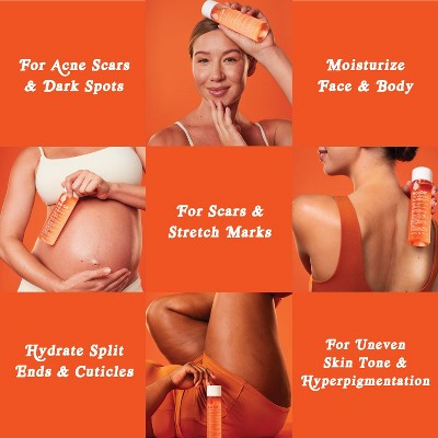 Bio-Oil Skincare Body Oil and Scar Treatment 4.2 fl oz - Missing Box