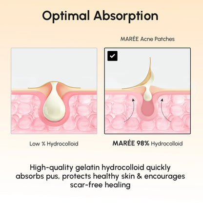Gold Star Pimple & Acne Patches