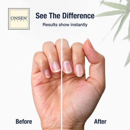 Essential Nail Reboot Kit (Serum)