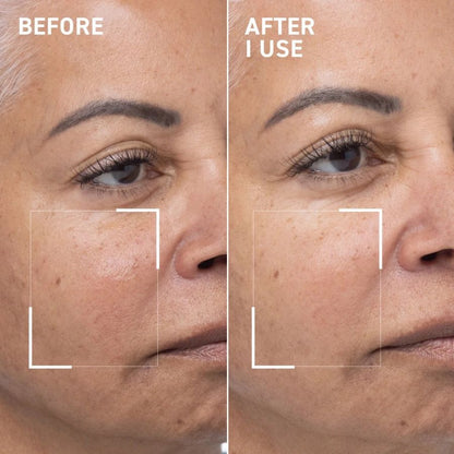 Dr. Brandt Oxygen Facial Mask Revitalizing Skin Treatment 50ml