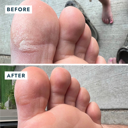 VOESH Heel Repair Duo - Repair Balm + Heel Socks