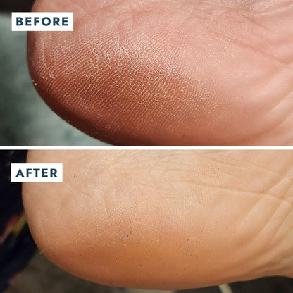 VOESH Heel Repair Duo - Repair Balm + Heel Socks